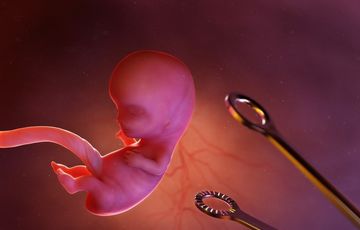 A Kádár-rendszer ősbűnei: Abortuszok