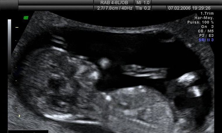 Screen Shot 2021-10-21 at 13.08.55